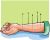 Acupuncture & Acupressure