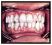 Perodontics and Restoration Dentistry